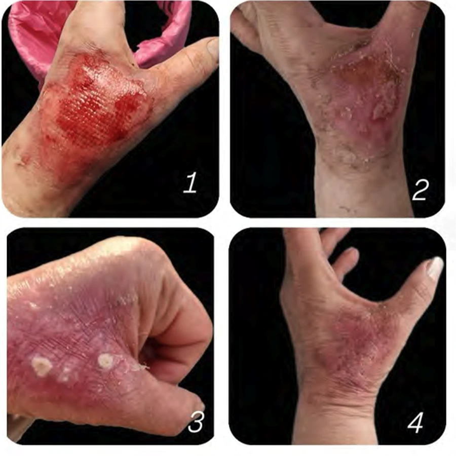 case5